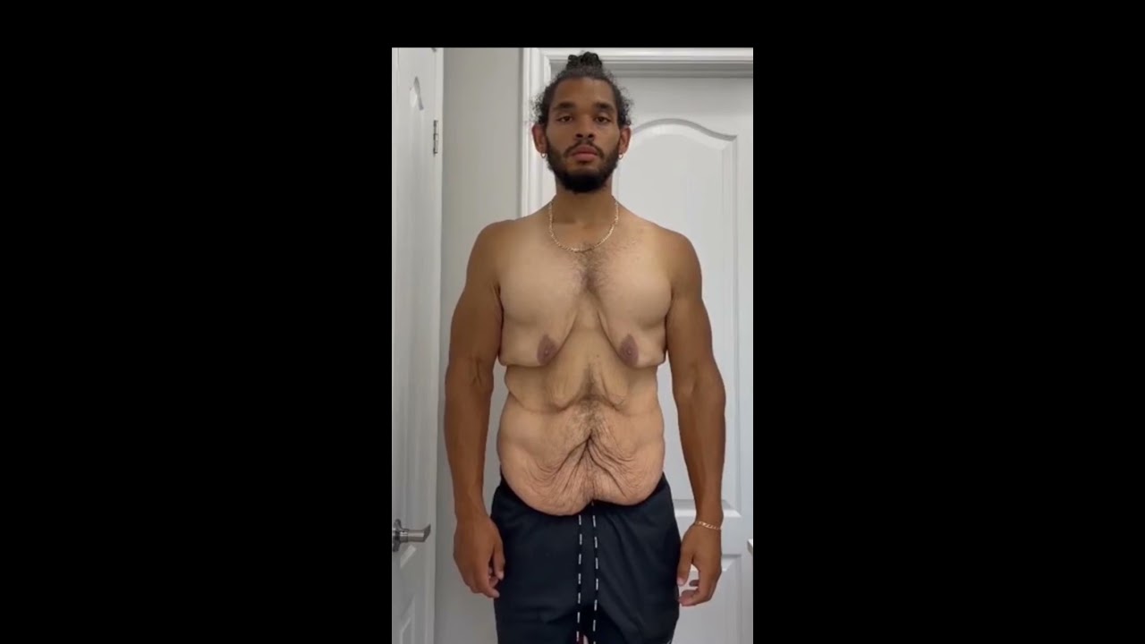 Weight Loss Transformation #SHORTS