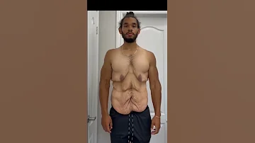 Weight Loss Transformation SHORTS 