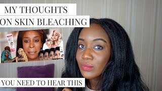 MY HONEST THOUGHTS ON SKIN BLEACHING - RESPONSE TO JACKIE AINA
