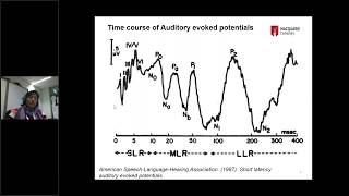 AUDIOLOGY PLANET WEBINAR : P300 Event Related Potentials