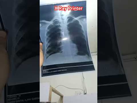 Epson X Ray L382 Printer Available X Ray Viralshort Problemsolved Officalvideo