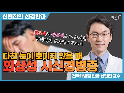 다친 눈이 보이지 않을 때 - 외상성 시신경병증(<strong>건국대병원</strong> 신현진 교수)[신현진의 신경안과#21]