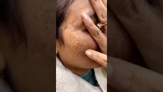 Tomato Facial At Home | Remove Dark Spots | Get Glowing &amp; Spotless Skin #shorts #skincare