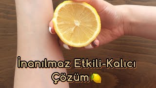 2 Dakikada Tüylerinizi Bitirin- Doğal Tüy Dökücü-KALICI ÇÖZÜM Resimi