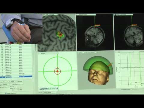 TMS Current Direction Control Over Targeted Brain Area