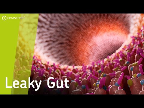 Leaky Gut: was passiert bei durchlässigem Darm? | Darmgesundheit