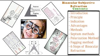 Binocular Subjective Refraction - Full Tutorial
