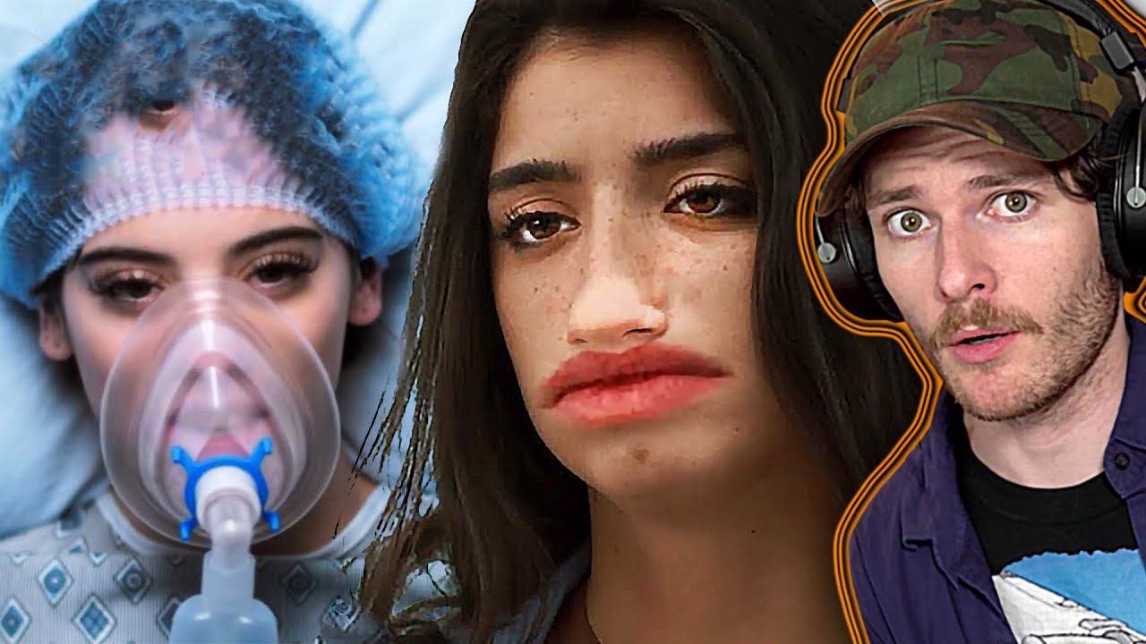 The Damelio's TV Show Is CRINGE...