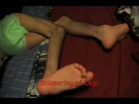 Living with Cerebral Palsy - YouTube.