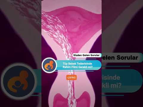 Tüp bebek tedavisinde