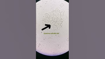 Red blood cells, epithelial cells and Bacteria in urine under the microscope #laboratory #microscope