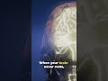 #adhd #audhd