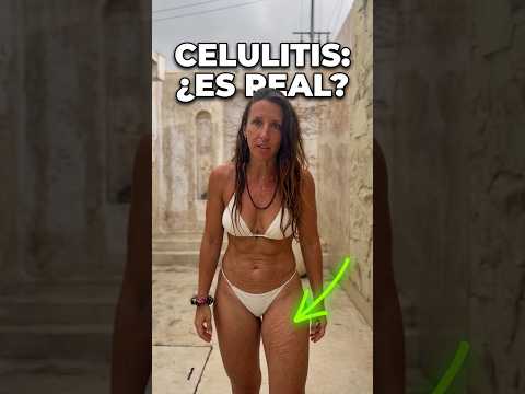 Fitness influencers vs cuerpos reales con celulitis #mujeresreales #cuerporeal #verdad