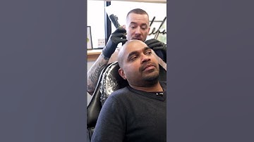 SMP IS A LIFE CHANGING HAIR-LOSS SOLUTION✍️ #shorts #scalpmicropigmentation #smp