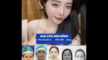 MŨI HỎNG KHÔNG BIẾT SỬA Ở ĐÂU? ĐẾN NGAY VỚI BÁC SĨ PHÙNG MẠNH CƯỜNG