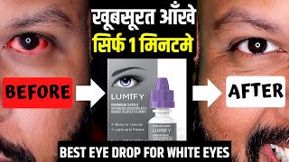 How to get bright eyes | Best eye drops for red eyes | Lumify eye drops