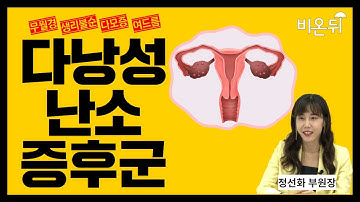 다낭성 난소 증후군(feat.생리불순,자궁 내막암)