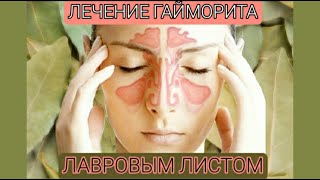 Как вылечить гайморит в домашних условиях лавровым листом