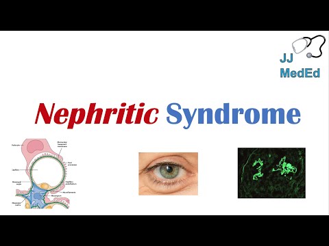 Nephritic Syndrome | Clinical Presentation, Causes and Treatment