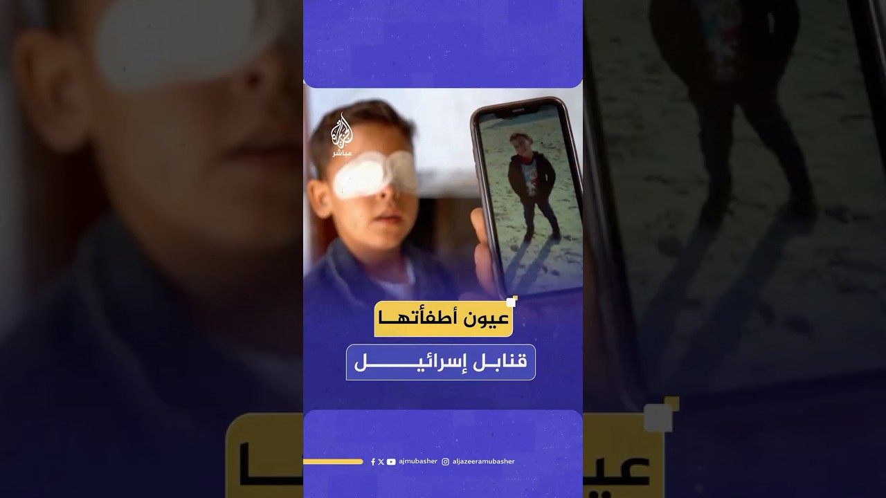 حاول اللعب بين الأنقاض فخطفت مخلفات الاحتلال الإسرائيلي بصره.. الطفل الفلسطيني محمد حجازي