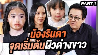 "น้องรินดา" สาวน้อยผิวด่างขาว..แตกต่างอย่างโดดเด่น! | ล้วงเรื่องเล่า Part 1