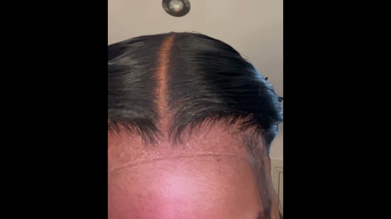 Melt band line always shows true dedication to making that lace look like scalp