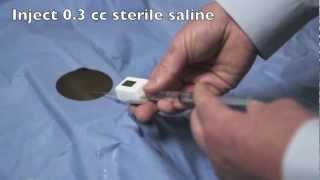 Compass™ Compartment Pressure Tutorial Wealth