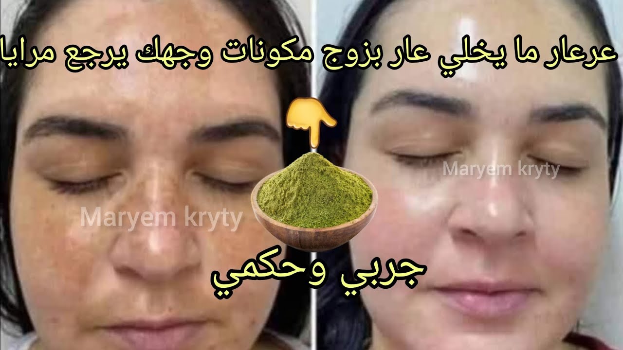 ماسك العرعار الرهيب لتبييض الوجه وإزالة التصبغات والبقع قولي وداعا للتجاعيد والبقع بشرة كالثلج👌