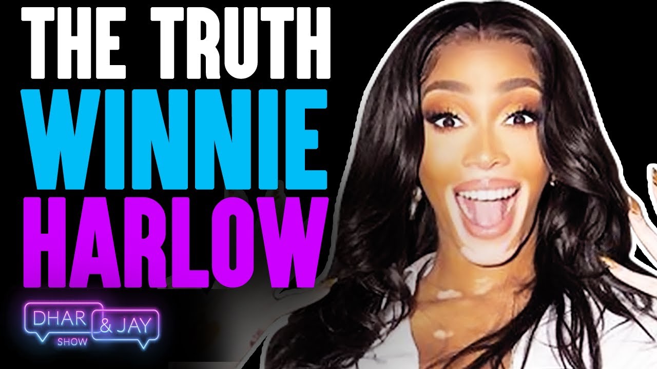 Winnie Harlow On Shooting With Beyoncé and Finding Confidence | Dhar