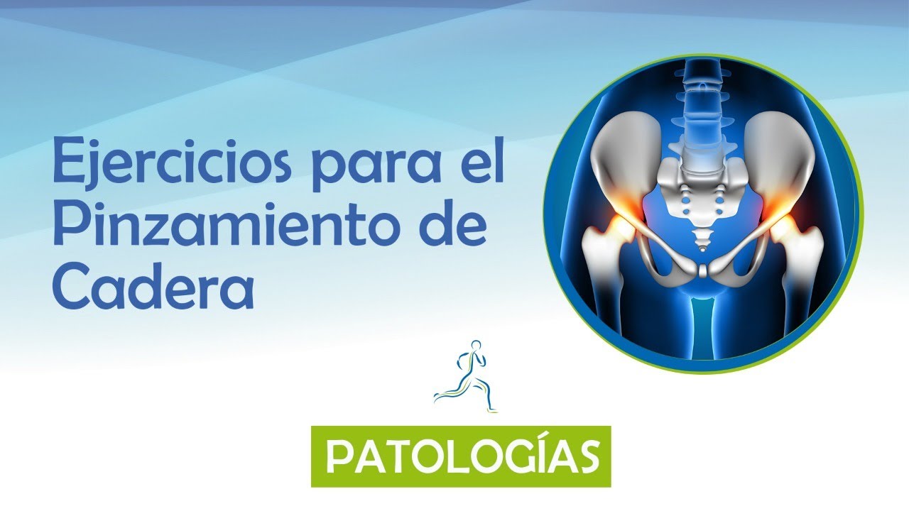 DOLOR DE CADERA: PINZAMIENTO FEMOROACETABULAR