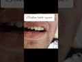 Dental treatments overview 🦷
