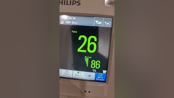 CTG pregnancy monitoring