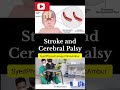 ✅PhysiotherapyOnly Meanwhile 👈✅SyedPhysiotherapy Clinic Ambur #physiotherapy #ambur🔥 #shortvideo