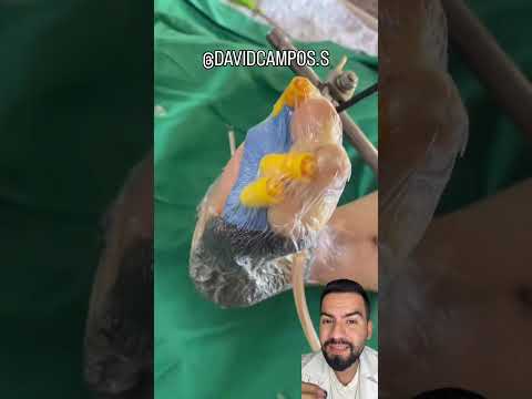 TERAPIA VAC