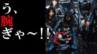 紅白で負傷の欅坂46平手友梨奈が、右腕の上腕三頭筋損傷のけがで全治1カ月! 上腕三頭筋損傷 検索動画14 紅白で負傷の欅坂46平手友梨奈が、右腕の上腕三頭筋損傷のけがで全治1カ月! 上腕三頭筋損傷 検索動画 14
