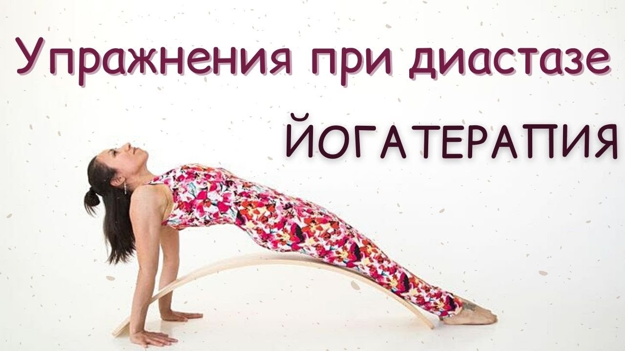 Диастаз | Йогатерапия