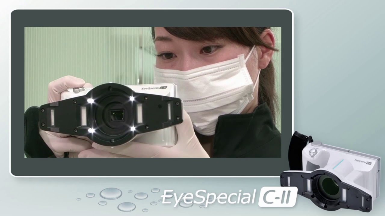 Câmera dental digital EyeSpecial C-II | Labordental