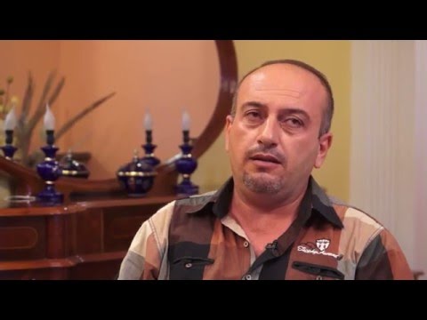 تجربة عادل في زراعة شعر الراس عند الدكتور علي قره خان قبل العملية 1