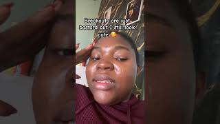 Cute Always Breakouts Or Not