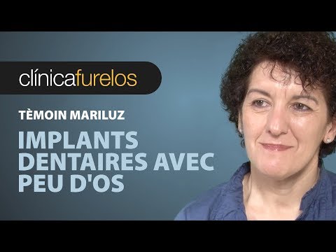 Vidéo: Des Restes Osseux étranges De Personnes De Casteidollo - Vue Alternative