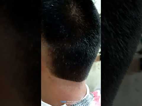 burstfade number 4