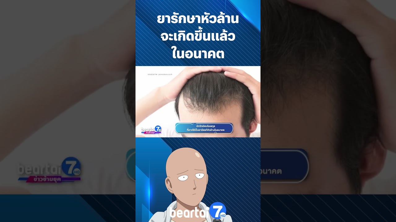 ยารักษา #หัวล้าน จะเกิดขึ้นแล้วในอนาคต #รักษาหัวล้าน #ผม #Hair #Hairloss #beartai7HD