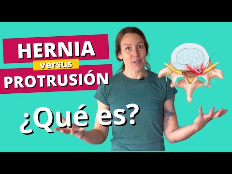 Hernia Discal y