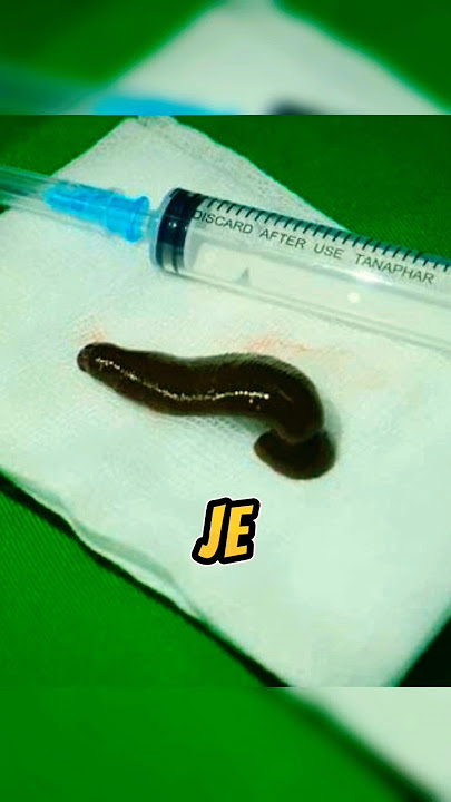 Pak Cik Ingat Sakit Tekak Biasa 😱 Rupanya!