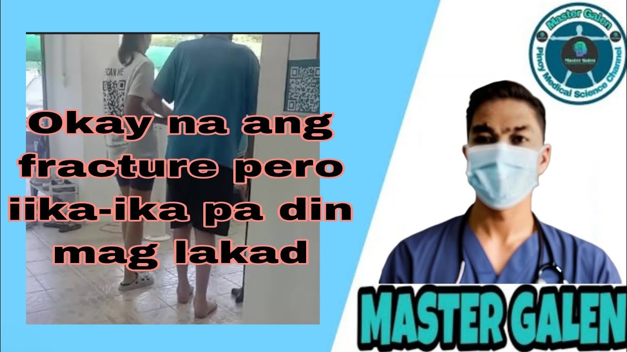 Magandang paglalakad  para sa magaling na nabaling buto