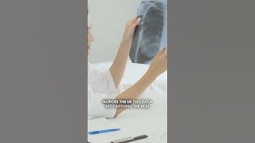 ReXGradient-160K: A Game Changer in Chest X-ray AI