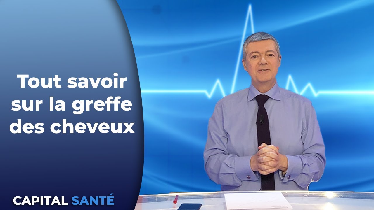 Tout savoir sur la greffe de cheveux