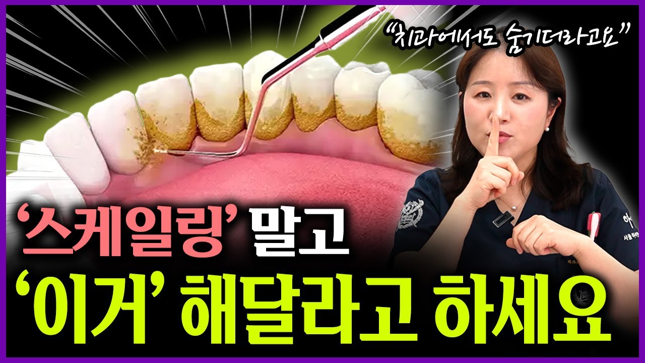 2만원으로 이런 효과를?! 치과에서 숨기는 '가성비 시술' 스케일링보다 100배 좋습니다