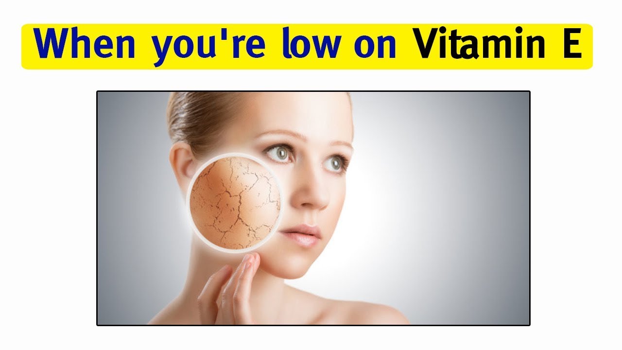 Vitamin E Deficiency Skin