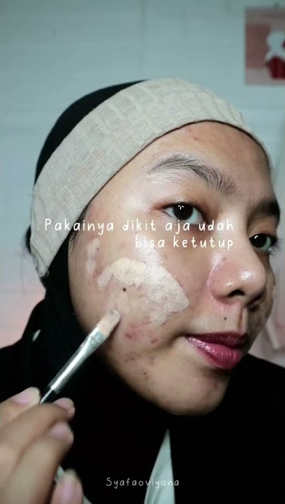 TIPS MENUTUP BEKAS JERAWAT@